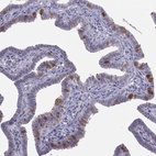 Immunohistochemical staining of human fallopian tube shows high expression.