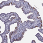 Anti-LRRC46 Antibody
