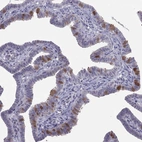 Immunohistochemical staining of human fallopian tube shows high expression.