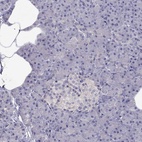 Immunohistochemical staining of human pancreas shows low expression as expected.