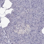 Immunohistochemical staining of human pancreas shows low expression as expected.