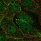 Immunofluorescent staining of human cell line MCF7 shows localization to nucleoplasm & plasma membrane.