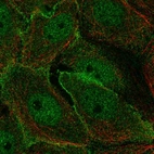 Immunofluorescent staining of human cell line MCF7 shows localization to nucleoplasm & plasma membrane.