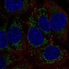 Immunofluorescent staining of human cell line MCF7 shows localization to mitochondria.