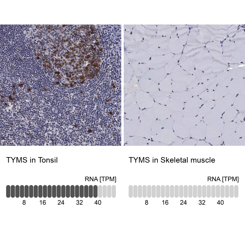 Anti-TYMS Antibody
