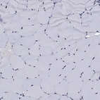 Immunohistochemical staining of human skeletal muscle shows low expression as expected.
