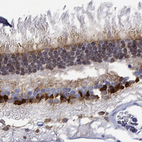 Anti-MSI1 Antibody