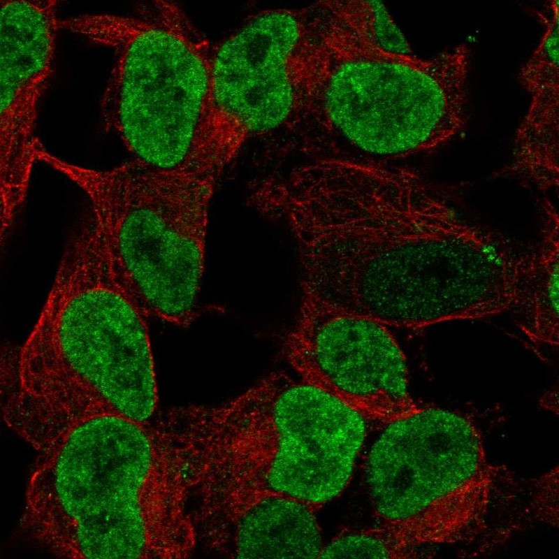 Anti-PHOX2B Antibody