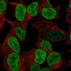 Anti-PHOX2B Antibody