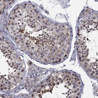 Anti-CNOT11 Antibody