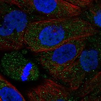 Anti-ADRA2B Antibody