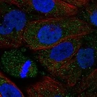 Anti-ADRA2B Antibody