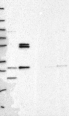 Anti-PMM1 Antibody