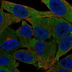 Immunofluorescent staining of human cell line SK-MEL-30 shows localization to cytosol.