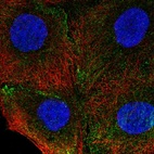 Anti-ITGA4 Antibody