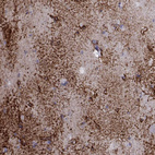 Anti-TMEM158 Antibody