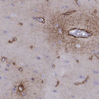 Immunohistochemical staining of human cerebral cortex shows moderate membranous positivity in glial cells and endothelial cells.