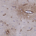 Immunohistochemical staining of human cerebral cortex shows moderate membranous positivity in glial cells and endothelial cells.