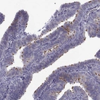 Immunohistochemical staining of human fallopian tube shows strong positivity in cilia in glandular cells.