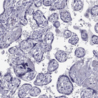 Immunohistochemical staining of human placenta shows no positivity in trophoblastic cells as expected.