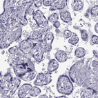 Anti-TMEM158 Antibody