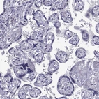 Immunohistochemical staining of human placenta shows no positivity in trophoblastic cells as expected.