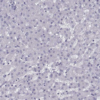 Immunohistochemical staining of human liver shows no positivity in hepatocytes as expected.