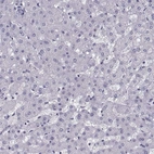 Immunohistochemical staining of human liver shows no positivity in hepatocytes as expected.