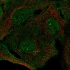 Anti-SIPA1L3 Antibody