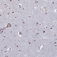 Anti-BRF1 Antibody