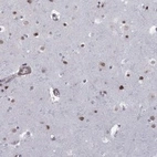 Anti-BRF1 Antibody