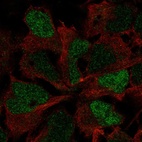 Anti-SOX3 Antibody