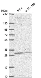 Western blot analysis in human cell line RT-4 and human cell line U-251 MG.