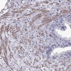 Immunohistochemical staining of human Prostate shows moderate cytoplasmic positivity in smooth muscle cells.