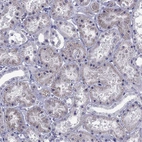 Immunohistochemical staining of human Kidney shows weak cytoplasmic positivity in cells in tubules.