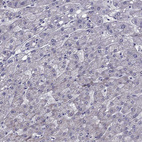 Anti-SLC16A8 Antibody
