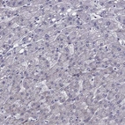 Immunohistochemical staining of human Liver shows no positivity in hepatocytes as expected.
