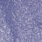Anti-SLC16A8 Antibody