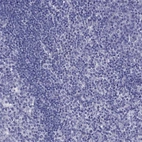Immunohistochemical staining of human Tonsil shows no positivity in non-germinal center cells as expected.