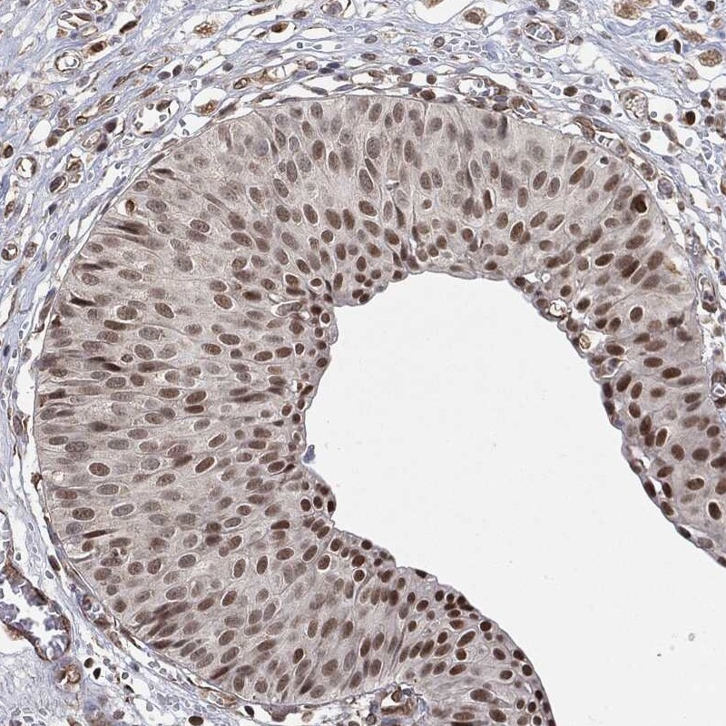 Anti-TP53RK Antibody
