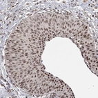 Anti-TP53RK Antibody