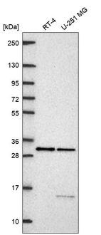 Western blot analysis in human cell line RT-4 and human cell line U-251 MG.