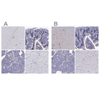 Immunohistochemical staining of human cerebral cortex, duodenum, pancreas and skeletal muscle using Anti-SCG2 antibody HPA075062 (A) shows similar protein distribution across tissues to independent antibody HPA011893 (B).