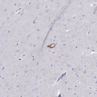 Immunohistochemical staining of human cerebral cortex shows strong cytoplasmic positivity in neuronal cells.