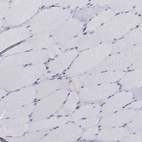 Immunohistochemical staining of human skeletal muscle shows no cytoplasmic positivity in myocytes as expected.