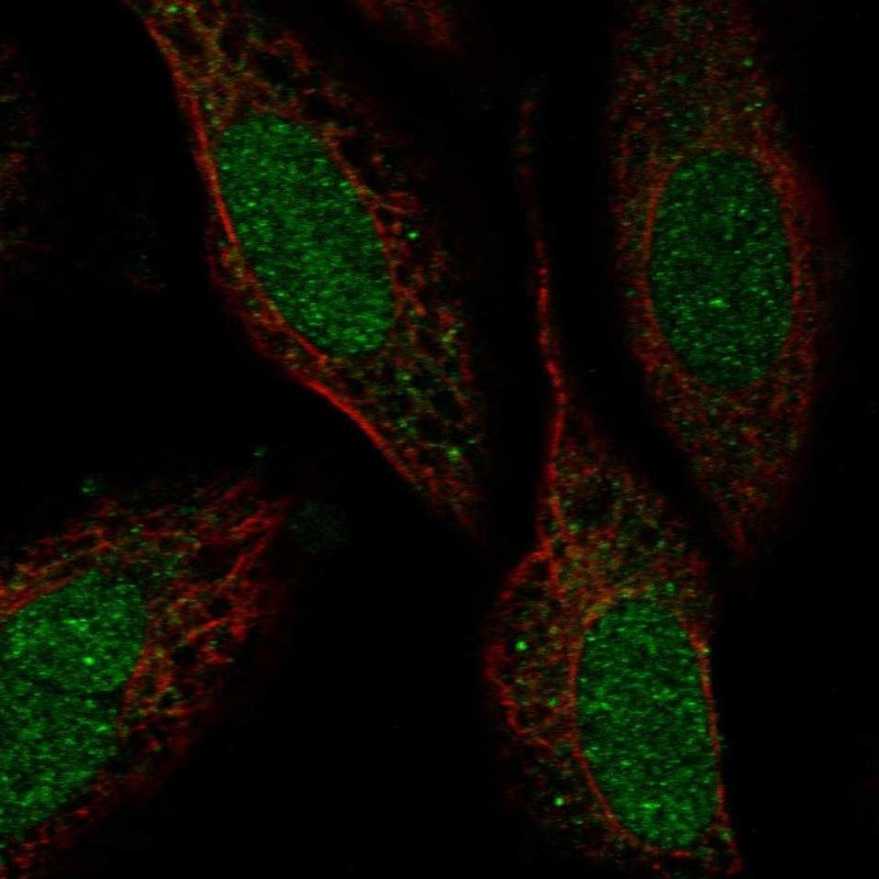 Anti-ZNF641 Antibody