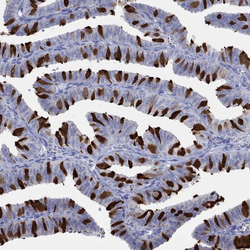Anti-IGFBP6 Antibody