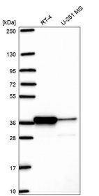 Anti-PIR Antibody