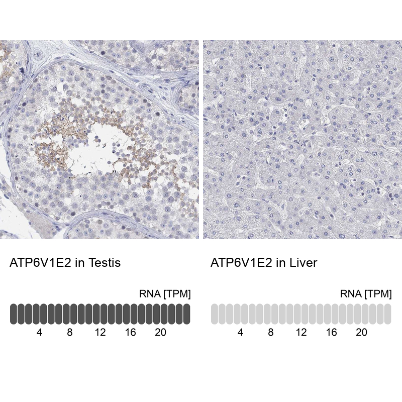 Anti-ATP6V1E2 Antibody