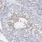 Immunohistochemical staining of human testis shows high expression.